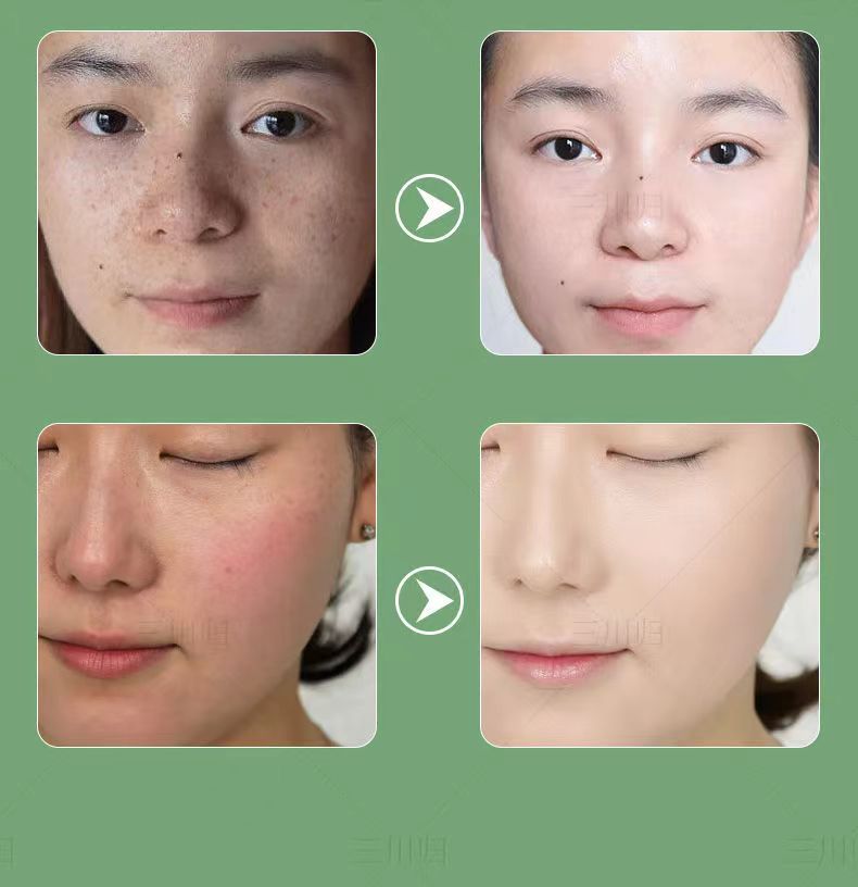 20220807105724788155.jpg 20.jpg